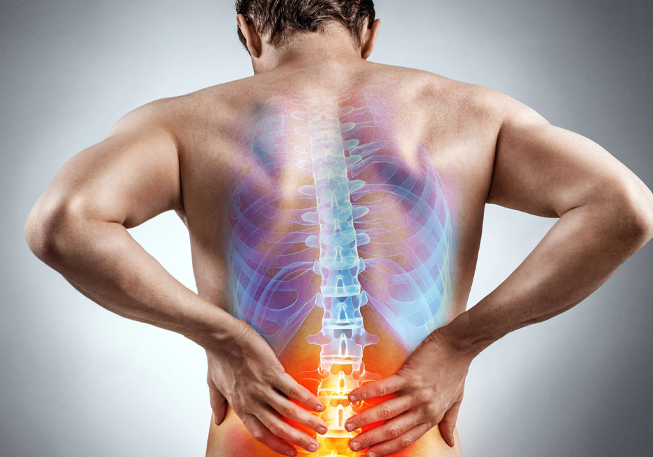 Drei Wege zur Lösung von Rückenschmerzen